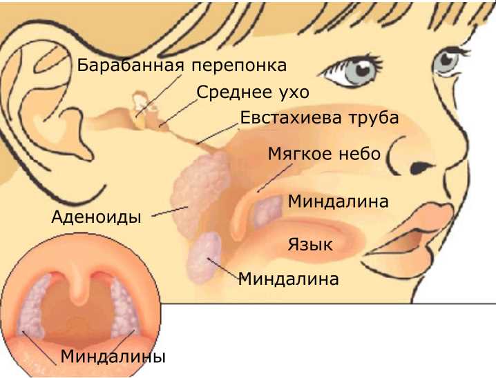 Влияние питания на аллергический ринит