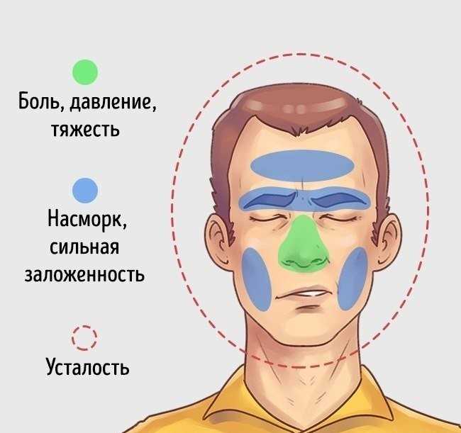 Аллергический гайморит — симптомы, причины, диагностика и надежное лечение у взрослых