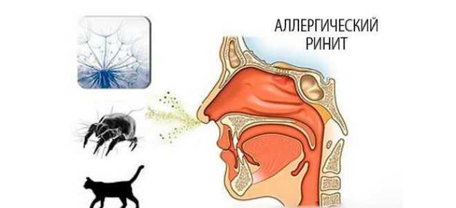 Какие есть методы для определения аллергического ринита?