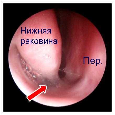 3. Кожные симптомы