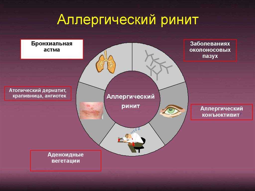 Аллергический ринит на шерсть — причины, симптомы и эффективные методы лечения