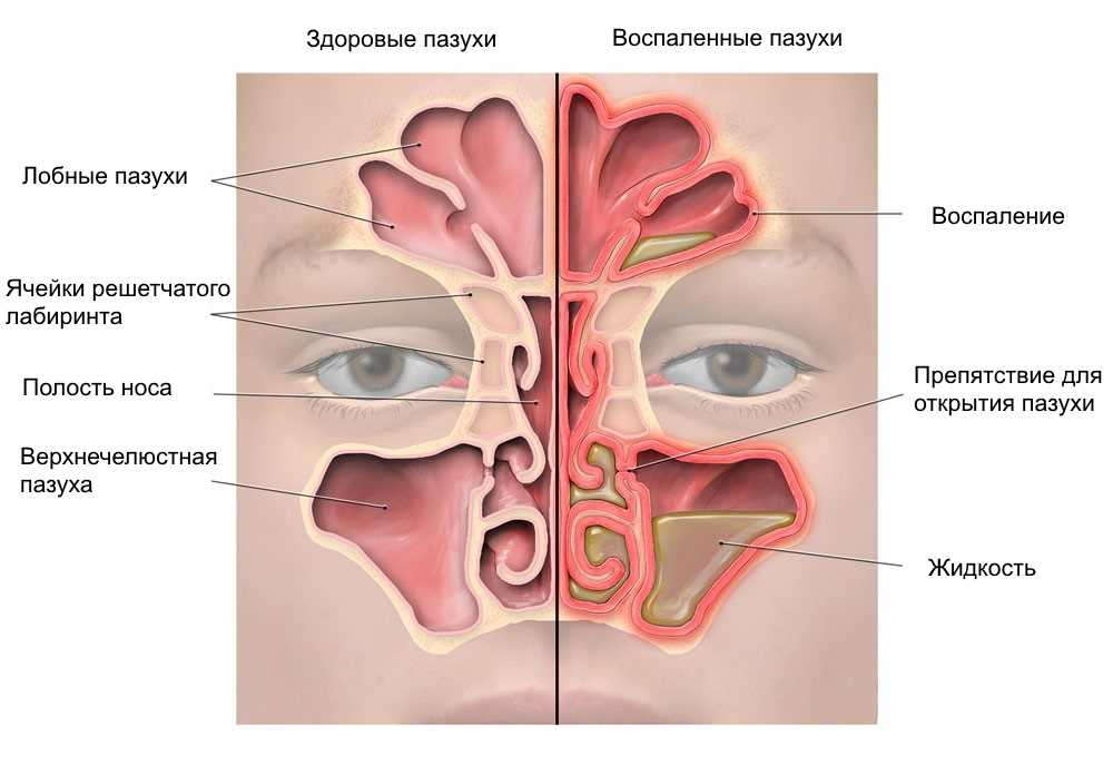 Диагностика аллергического ринита