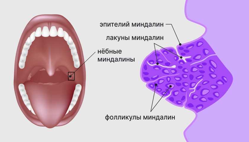 Настройт