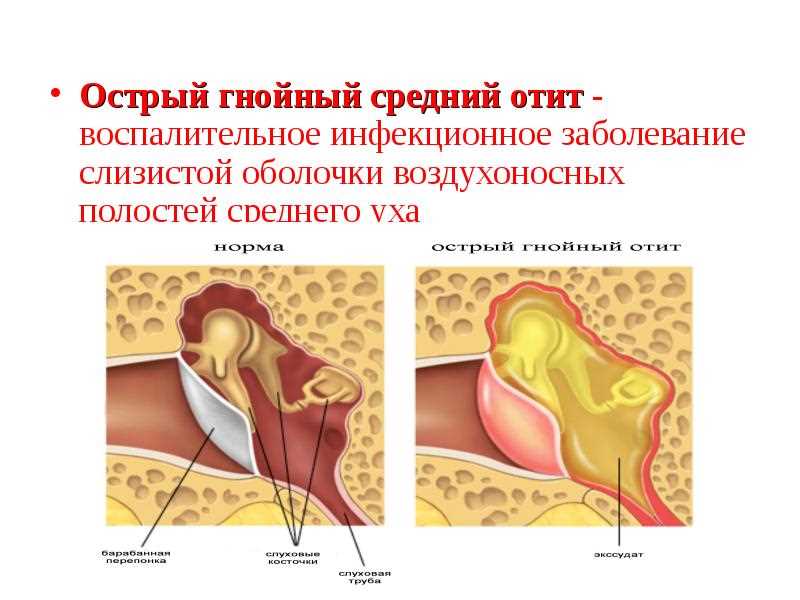 Снижение давления в ушах