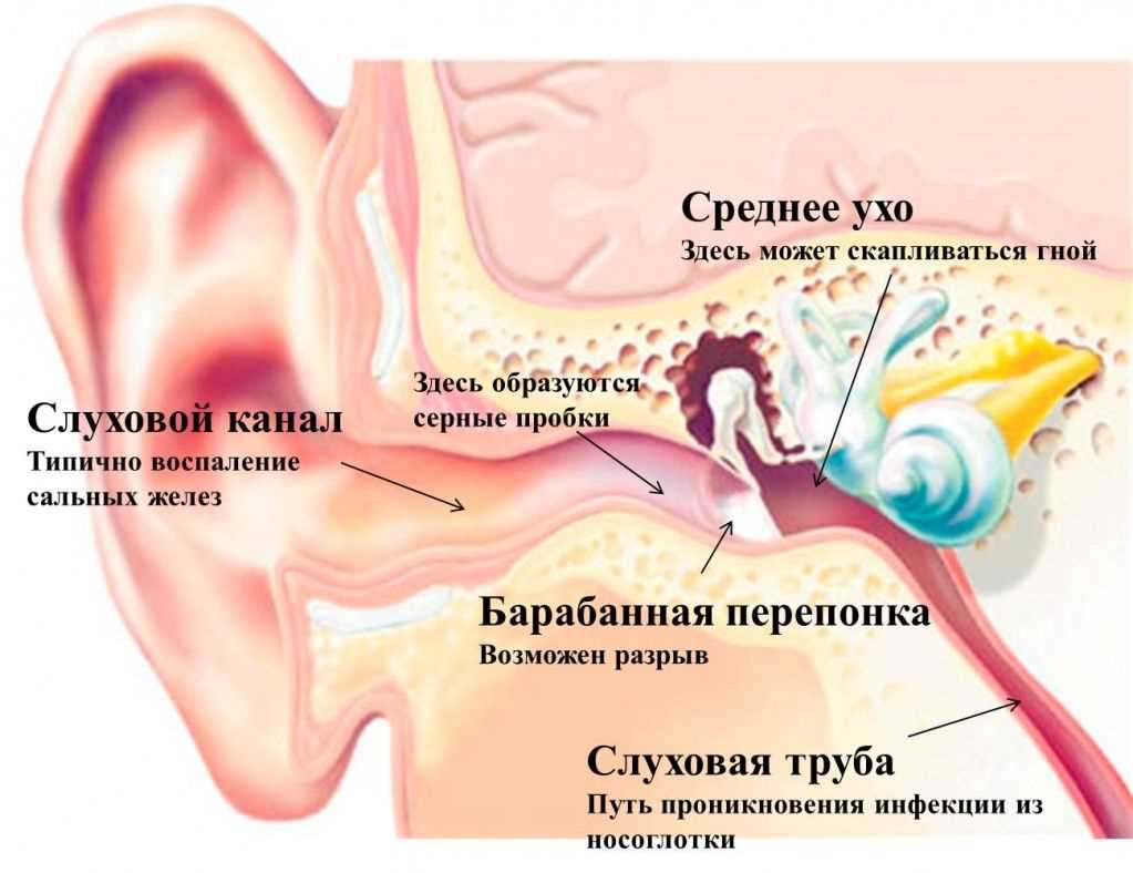 Как эффективно лечить боль в ухе при насморке — проверенные методы и полезные советы