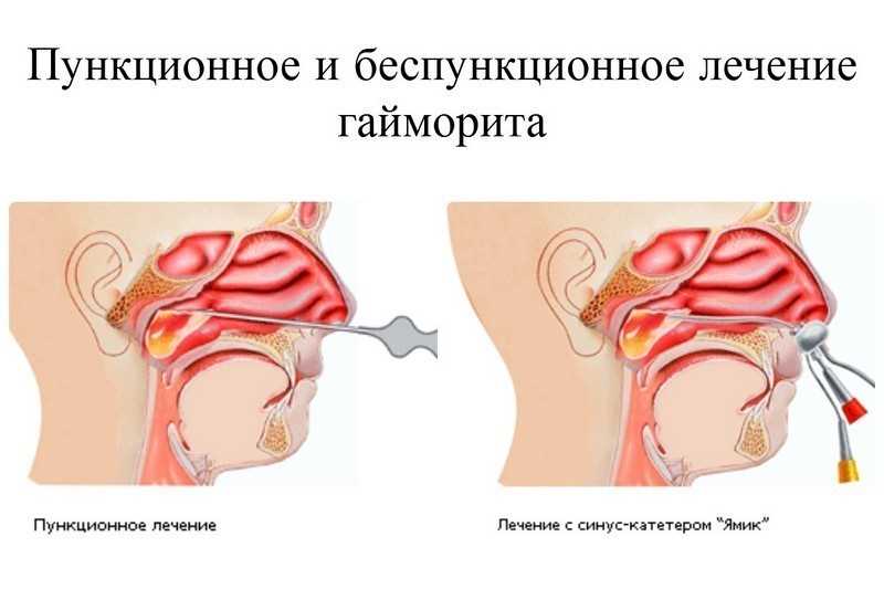 Процесс лечения: