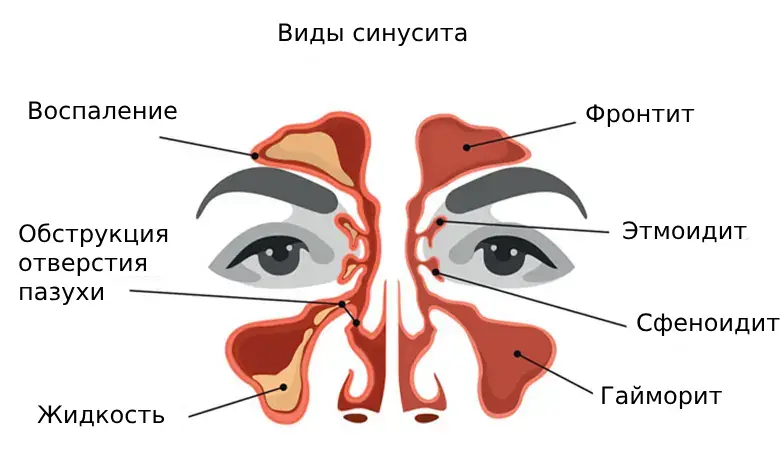 Наряду с применением антибиотиков