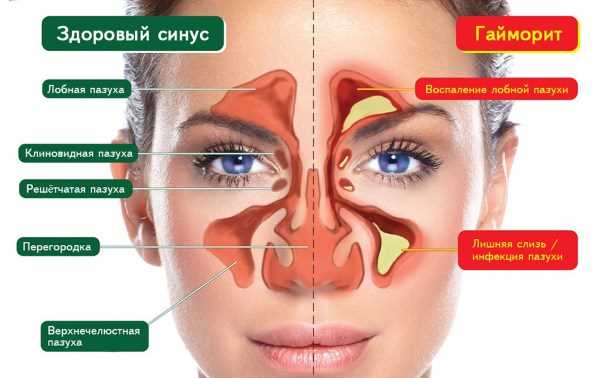 Положительные результаты лечения звездочкой