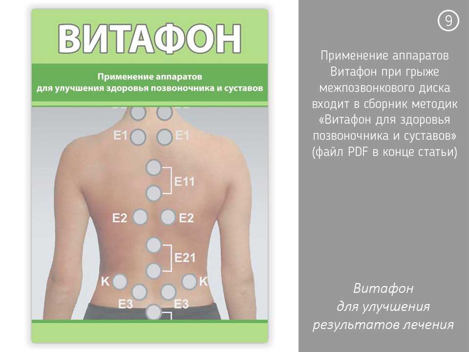 Области воздействия и места установки виброфонов