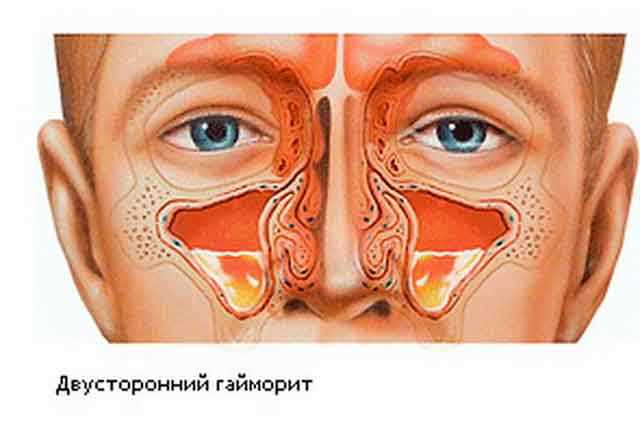 Физиотерапевтические методы лечения