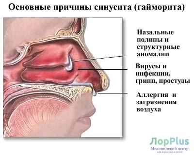 2. Рентгенография и компьютерная томография (КТ)