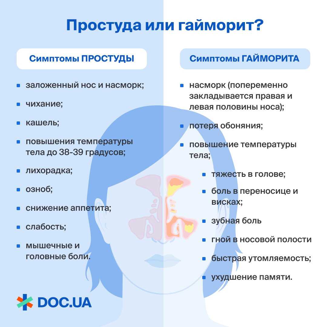 Методы диагностики и лечения острого гайморита