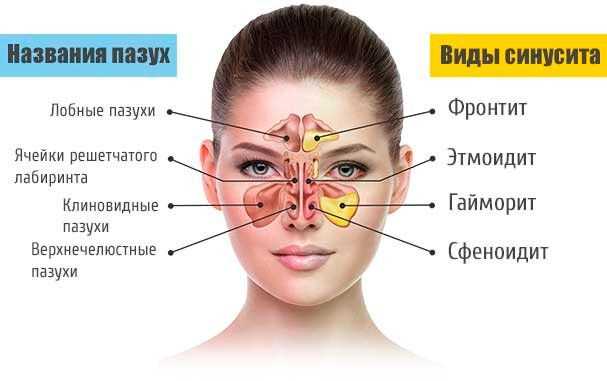 ЧТО ДЕЛАТЬ ПРИ БОЛИ ПАЗУХ НОСА