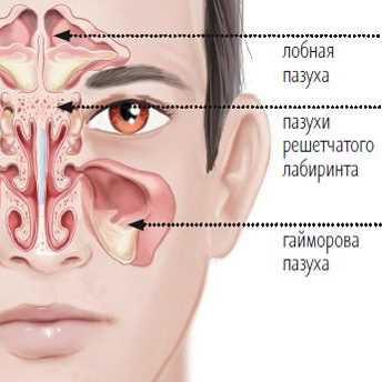 Лечение повторного гайморита
