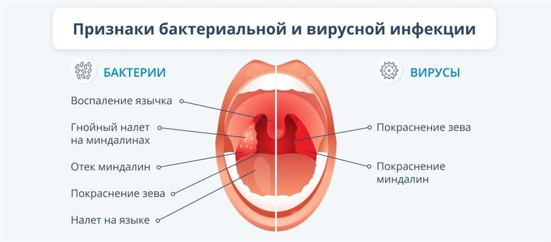 Народные средства от першения в носоглотке