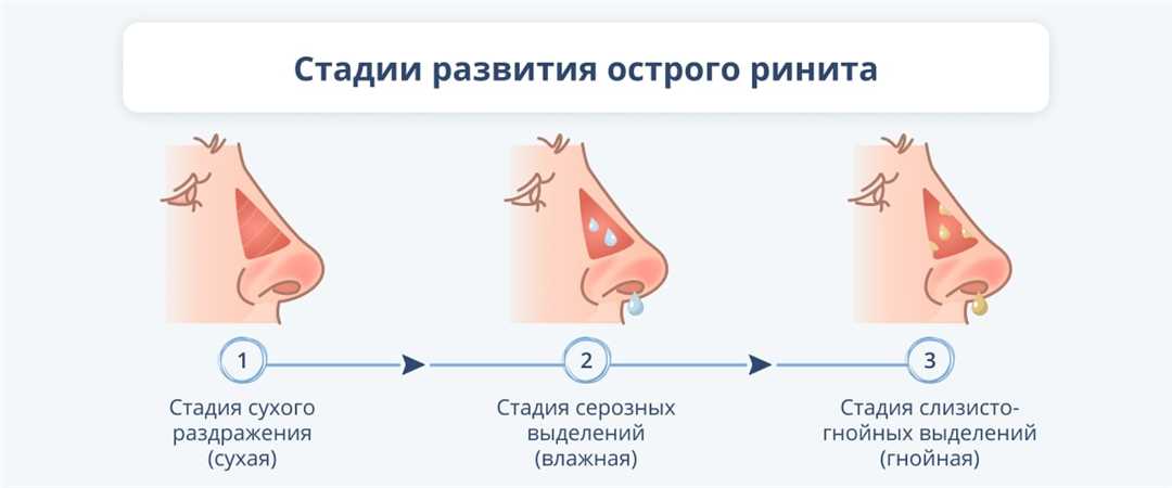 2. Жжение и зуд в носу: