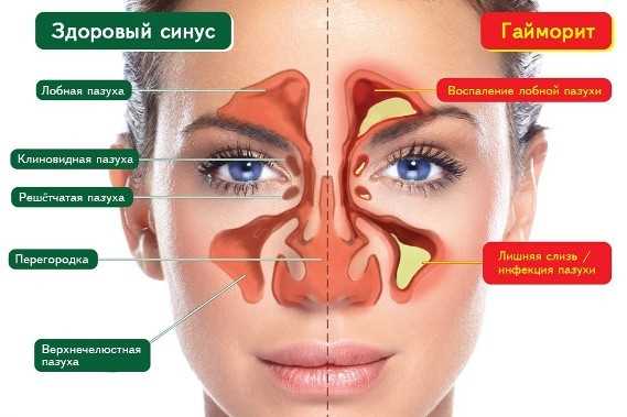 Носовые капли и спреи