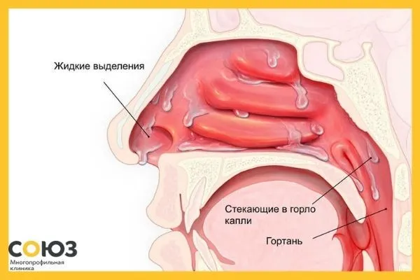 Показания к применению