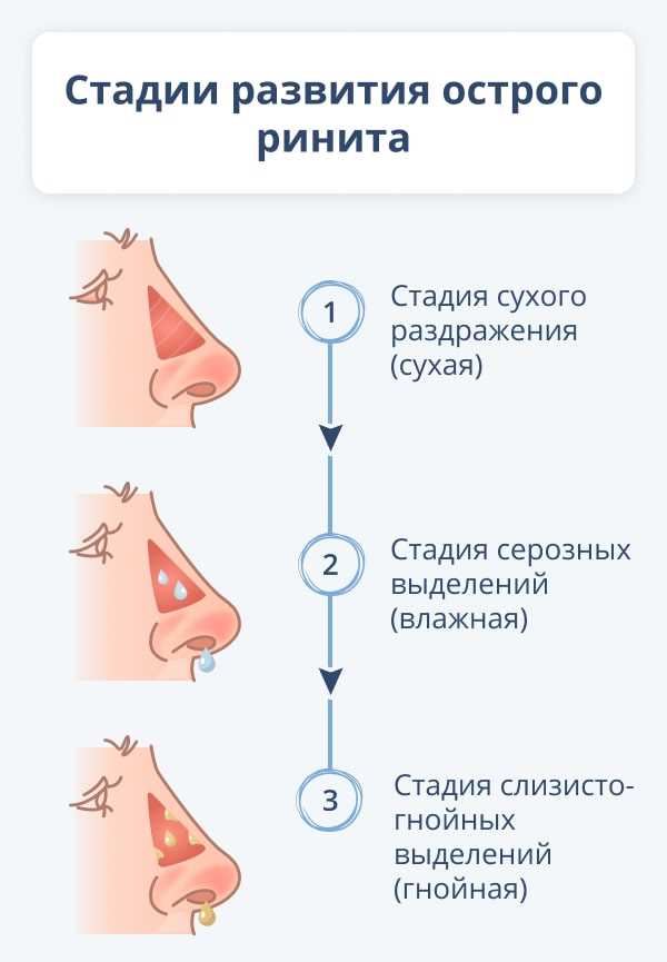 Аллергия на компоненты препарата