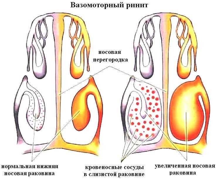 Медикаментозное лечение