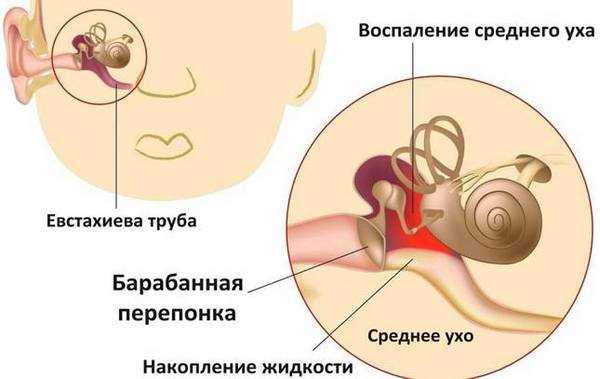 Антибактериальные препараты